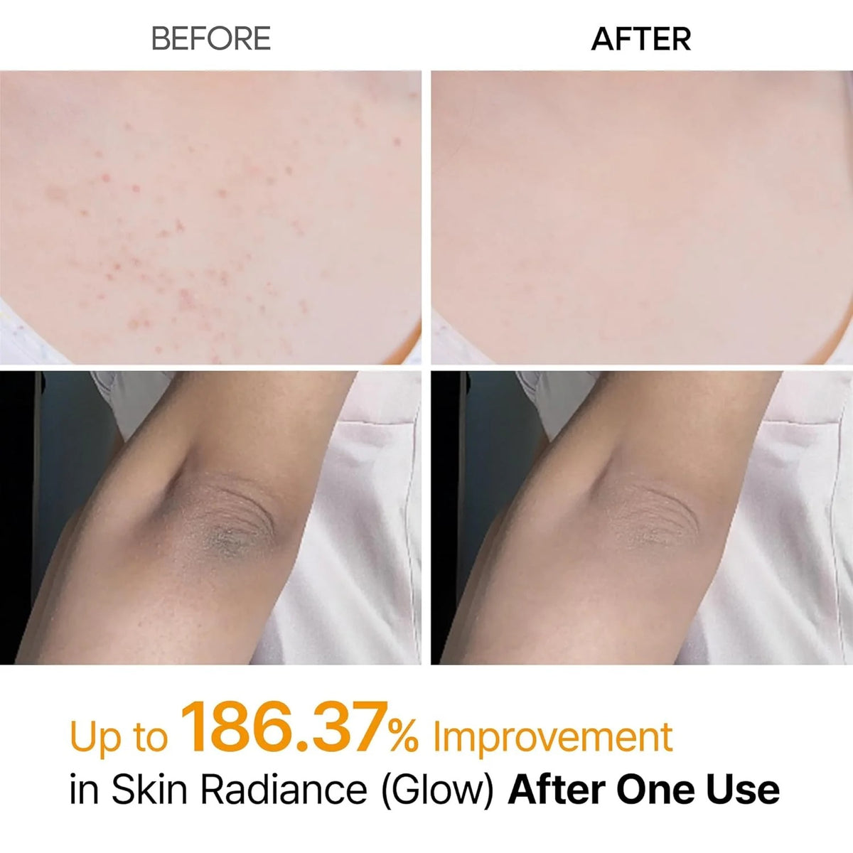Exfoliating Kojic Acid & Turmeric Spray